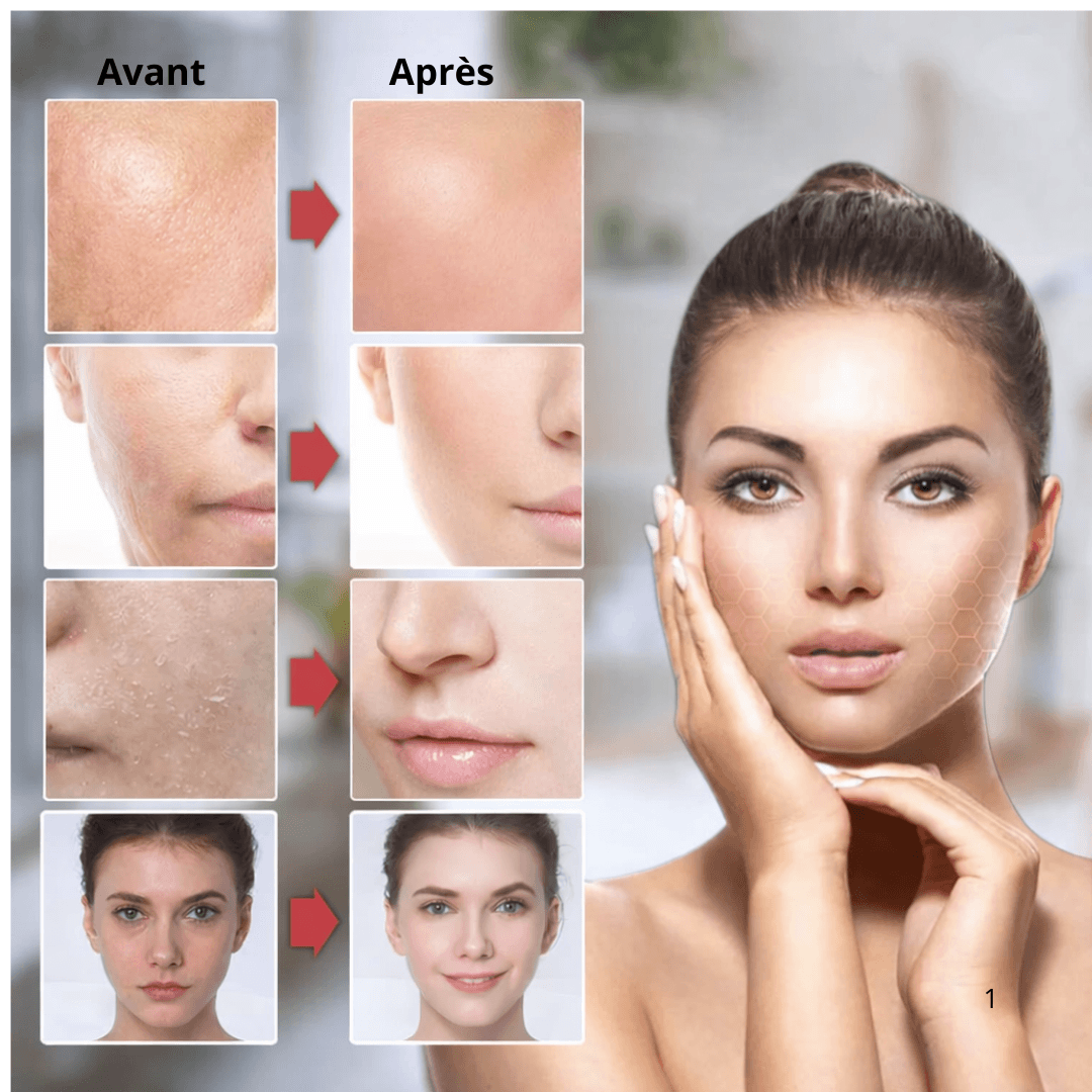 Appareil massage visage hifu avant apres peau